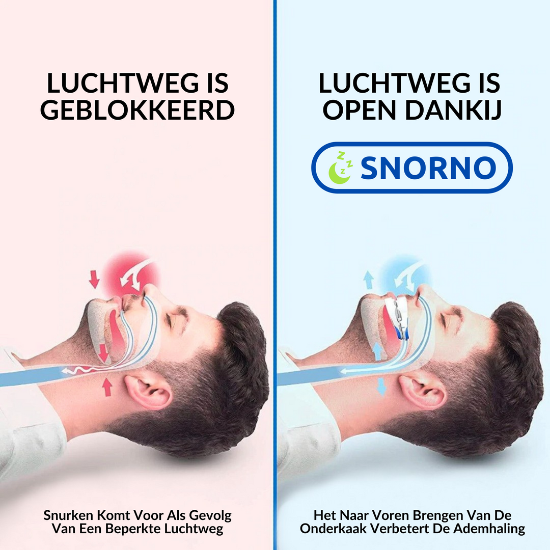 Flexibel anti-snurk mondstuk voor een comfortabele en persoonlijke pasvorm, essentieel voor rustige nachten.