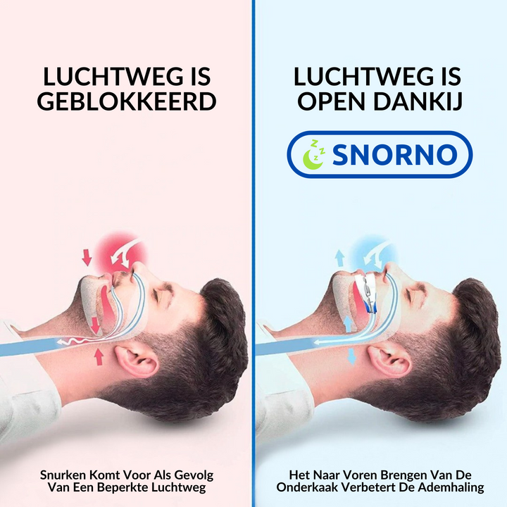 Flexibel anti-snurk mondstuk voor een comfortabele en persoonlijke pasvorm, essentieel voor rustige nachten.