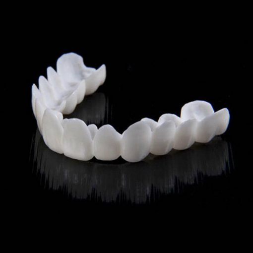 Eenvoudig aanbrengen van Smile Veneers: snelle en betaalbare oplossing voor een perfecte glimlach.