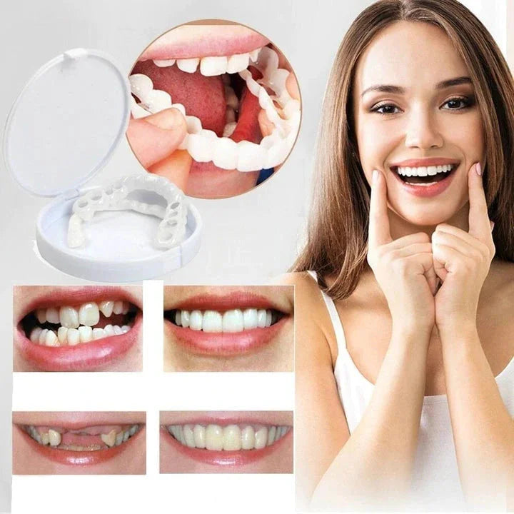 Voor en na: transformatie met Smile Veneers voor wittere tanden en een zelfverzekerde glimlach.