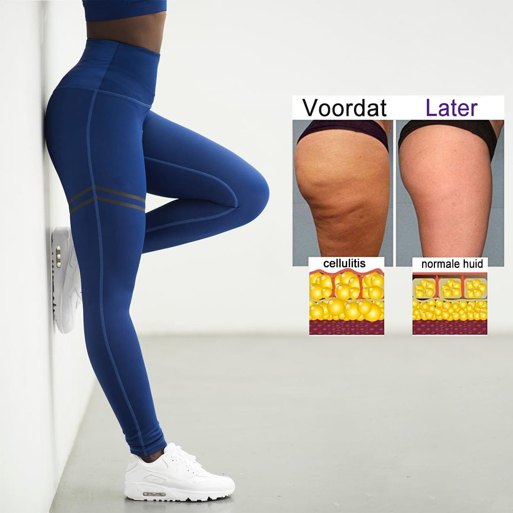 Comfortabele figuurcorrigerende dames compressielegging. Anti-cellulitis effect met hoge taille voor fitness & yoga.