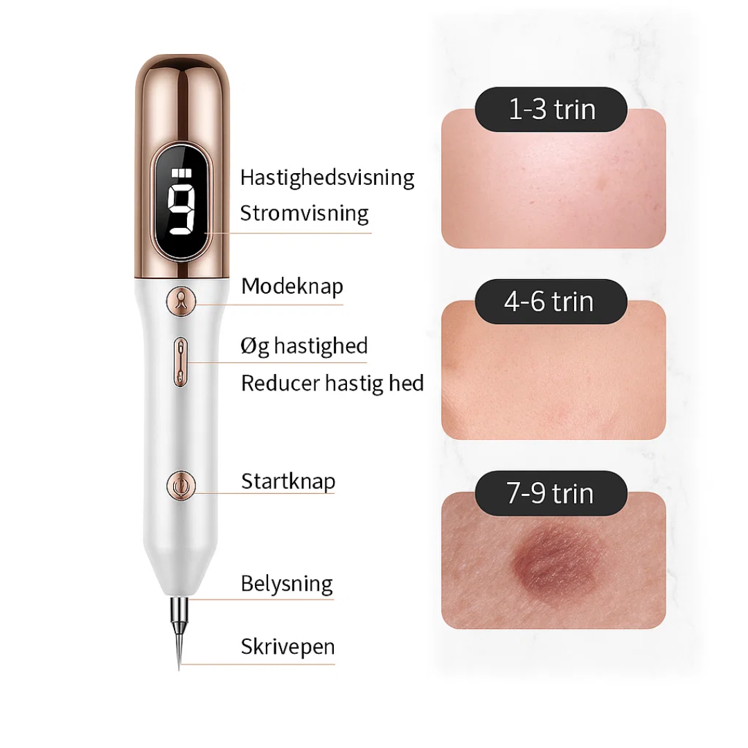 Detail van de Plasma-Pen; de ultieme huidverzorgingstool tegen pigmentvlekken en onzuiverheden.