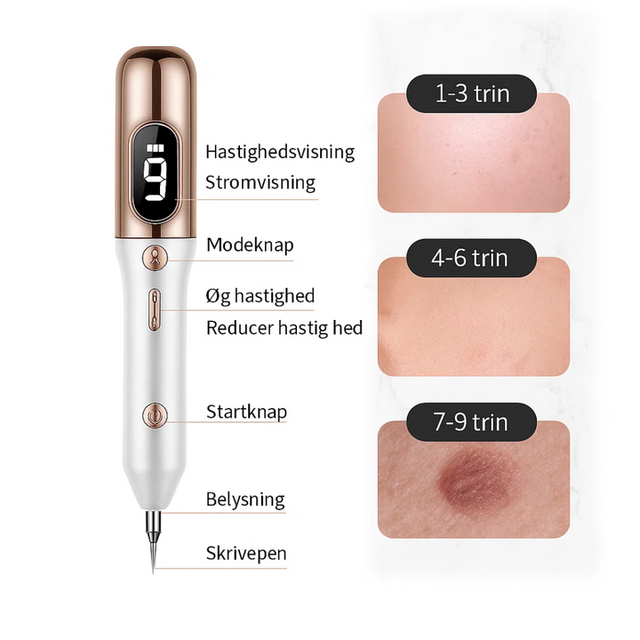 Detail van de Plasma-Pen; de ultieme huidverzorgingstool tegen pigmentvlekken en onzuiverheden.