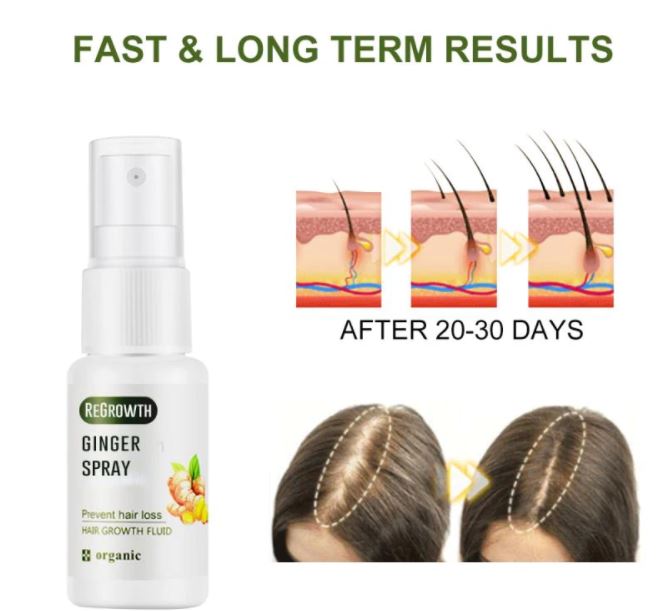 Gember Haar Groeispray met gemberwortel illustratie. Natuurlijke oplossing voor voller haar en tegen kaalheid.