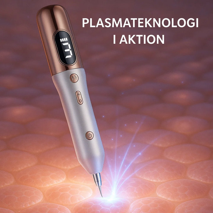 Hand die Plasma-Pen vasthoudt voor nauwkeurige verwijdering van moedervlekken en wratten.