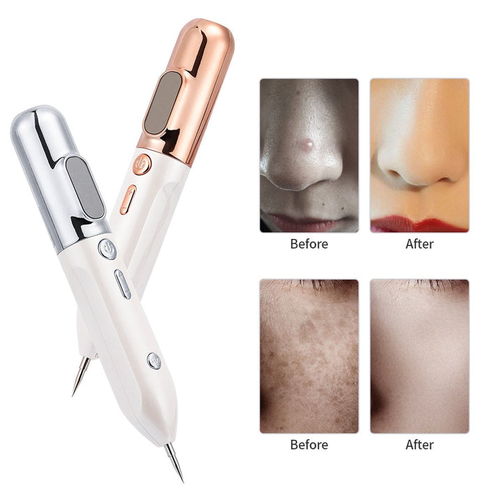 Gedetailleerde weergave van de GlowLift Plasma Pen, een geavanceerd schoonheidsapparaat voor huidverjonging.