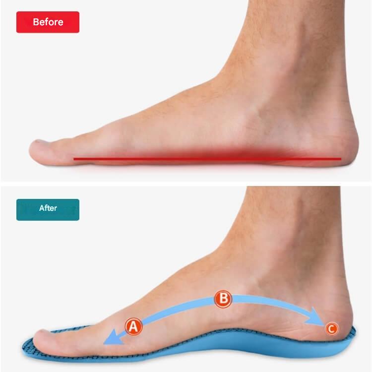 Comfortabele StepRelief traagschuim inlegzolen voor hielspoor verlichting, demping en superieur voetcomfort.