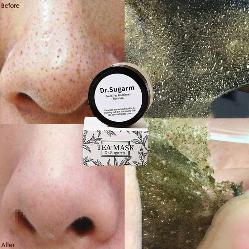 Vrouwenhand brengt detox masker aan, verfijnt poriën en verwijdert mee-eters voor stralende huid.