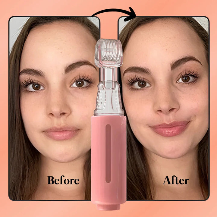 Close-up van volle, sensuele lippen na behandeling met de natuurlijke lippenbooster set. Cosmetica thuis.