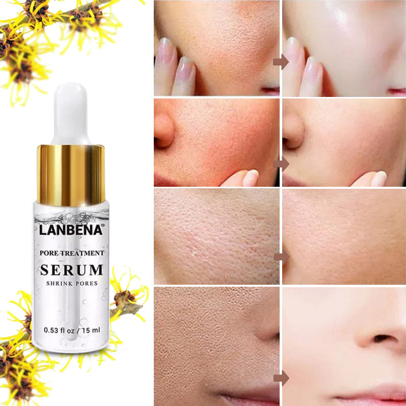 Hoogwaardig natuurlijk serum voor de poriën; perfecte huidverzorging voor vrouwen met onzuiverheden en korting.
