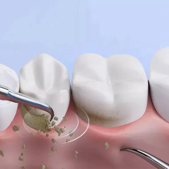 Draagbare, oplaadbare ultrasone tandsteenverwijderaar voor thuis. Optimale mondhygiëne en stralende tanden.