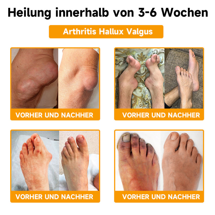 Vegan anti-aging bijengifcrème met hyaluronzuur en collageen voor luxe huidverjonging.