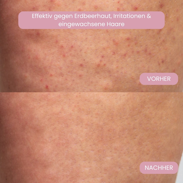 Compacte elektrische bikini trimmer voor persoonlijke verzorging, draadloos en effectief.