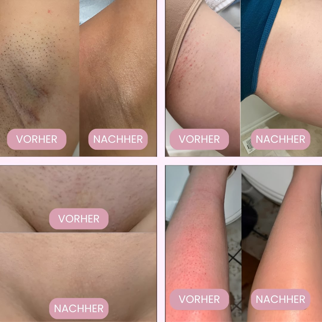 USB oplaadbaar elektrisch bikinischeerapparaat roze, voor gladde en zijdezachte huid.