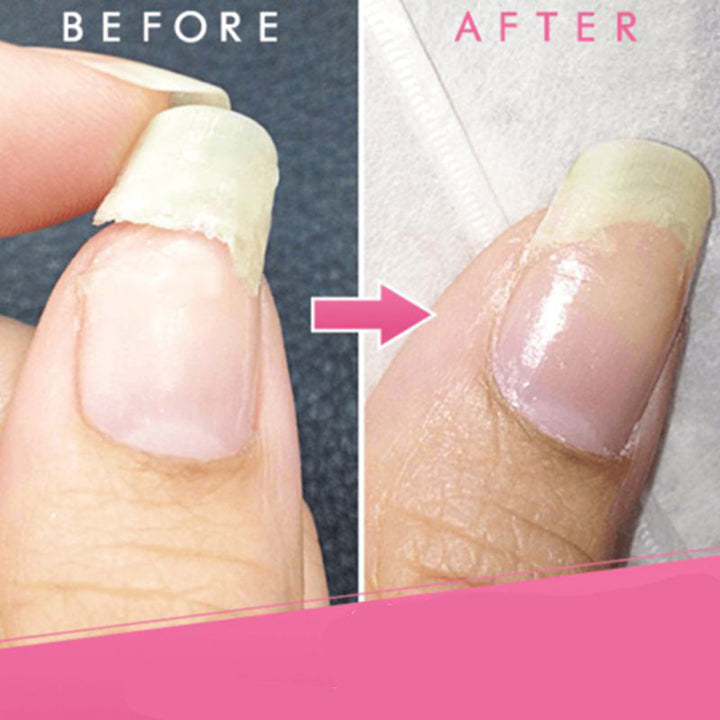 Transparante nagelgel voor dames die zorgt voor sterke, glanzende nagels en snel herstel.