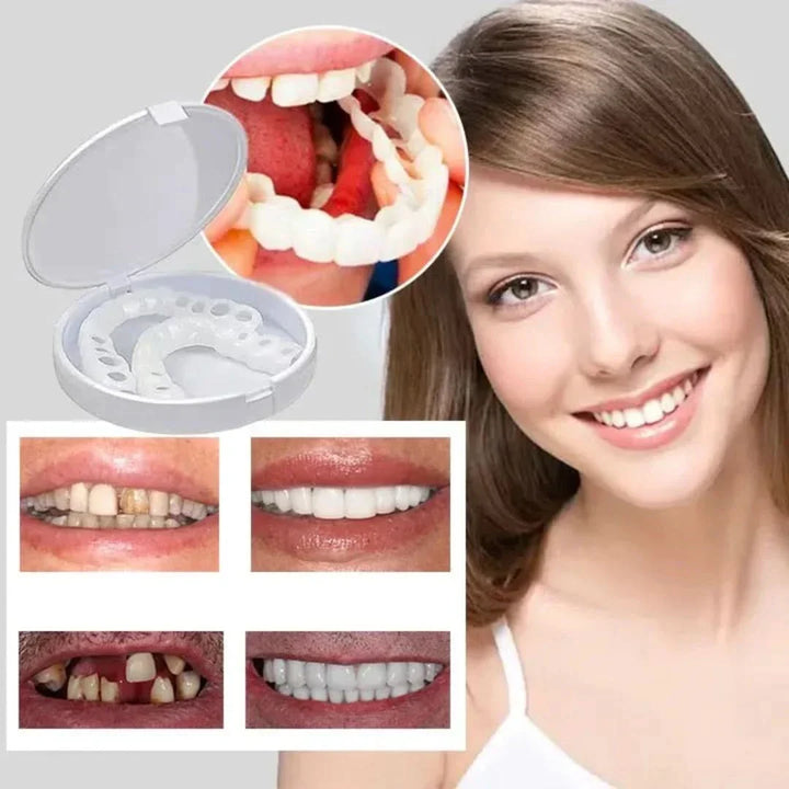 Verstelbare en herbruikbare snap-on gebitsprothese, biedt direct een stralende glimlach en comfort.