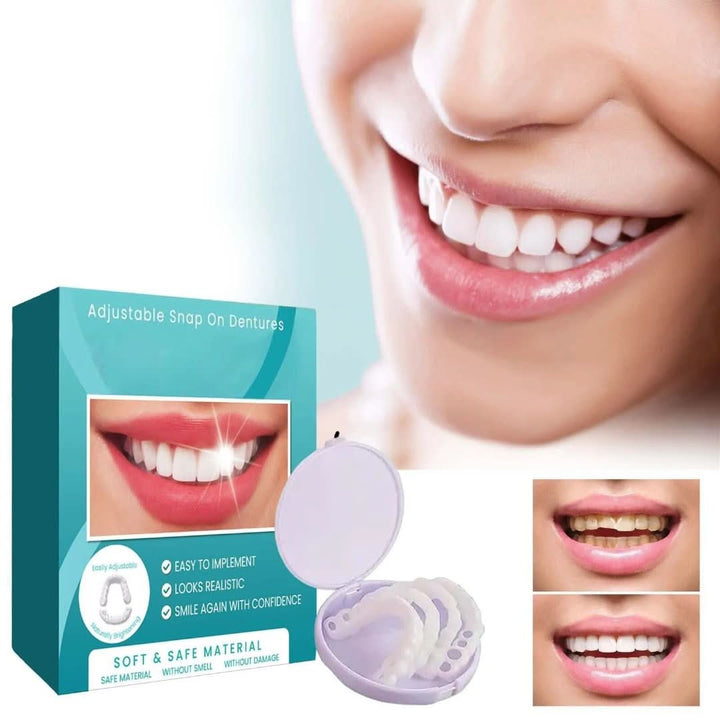Cosmetische snap-on gebitsprothese voor een perfecte glimlach. Verstelbaar en comfortabel voor dagelijks gebruik.